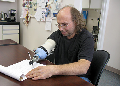 Upper extremity amputee